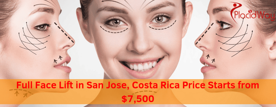 Full Face Lift Cost in San Jose, Costa Rica